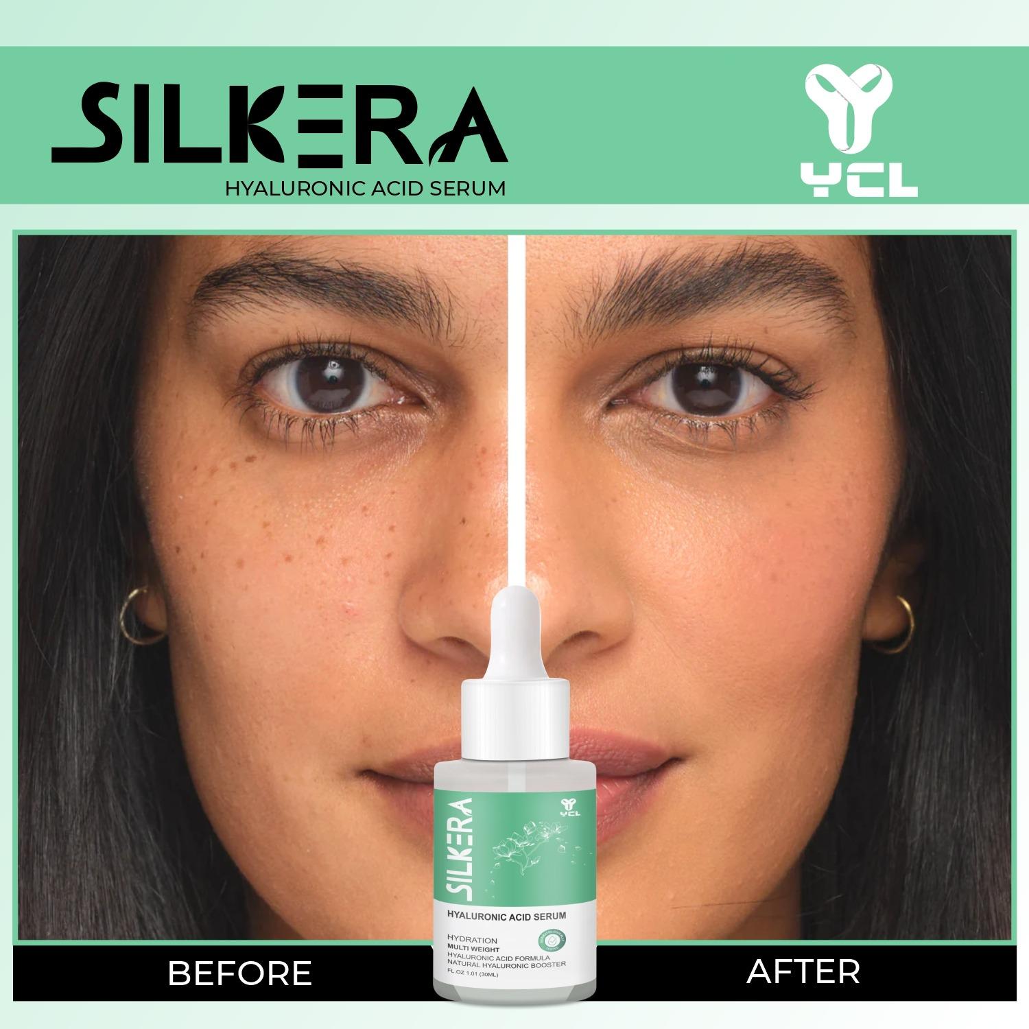 Silkera Hyaluronic Acid Serum - Image 6