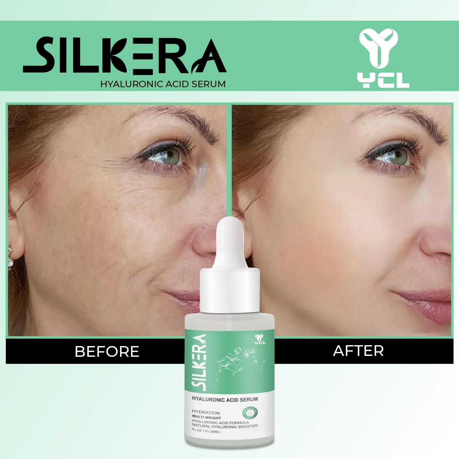 Silkera Hyaluronic Acid Serum - Image 5